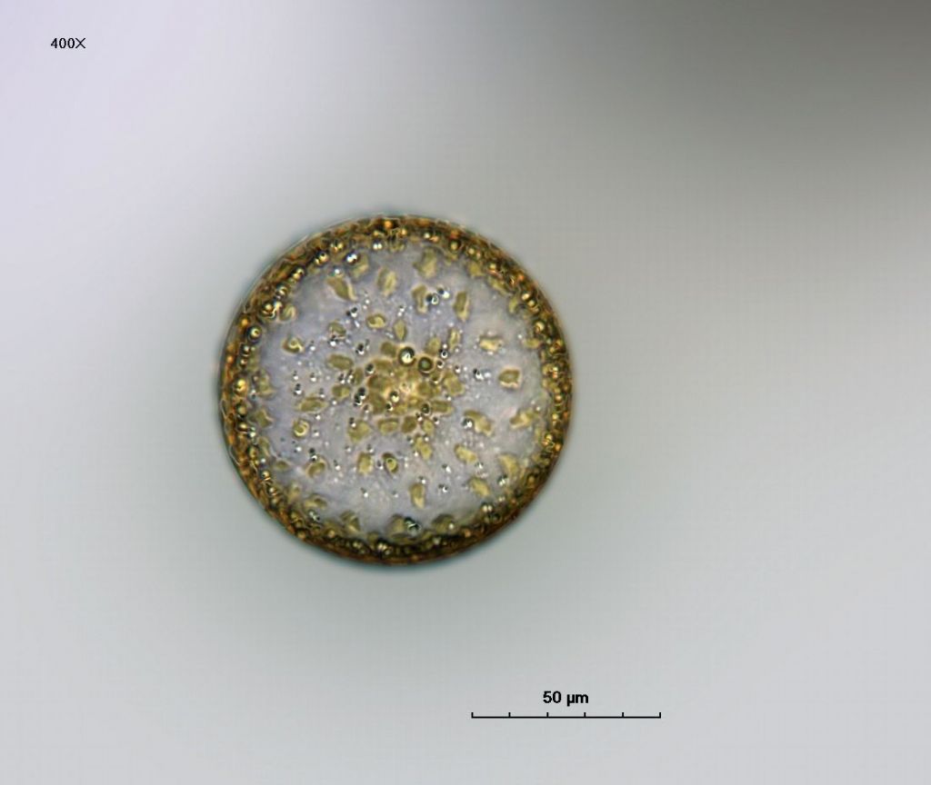 Coscinodiscus sp.